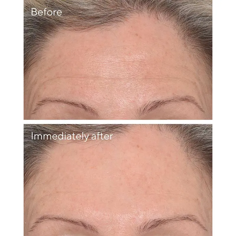 Murad Resurgence Targeted Wrinkle Corrector